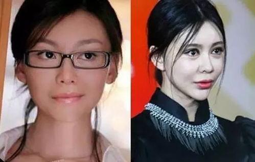 为什么明星都爱整容,揭秘美丽背后的秘密与动机